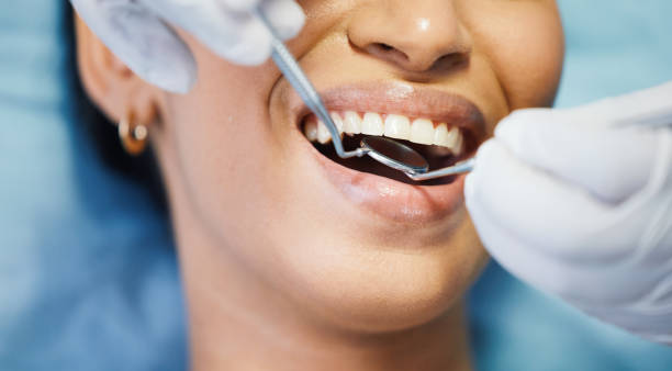 Best Root Canal Emergency Dentist  in Streamwood, IL